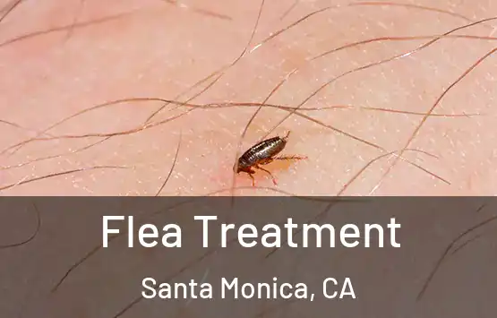  Flea Treatment Santa Monica, CA